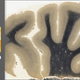 Illustration for article titled NMHMC Harvey: Check Out Einsteins Crazy Brain